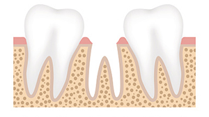 Rendering of a missing tooth between two healthy teeth at East Village Dental Centre