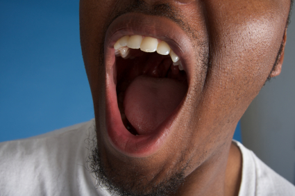 Everything You Need to Know About Dry Mouth