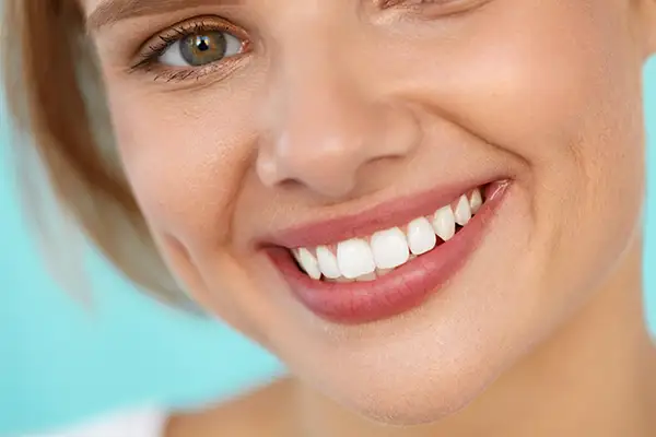 A close-up of a woman's perfect smile with bright white teeth.