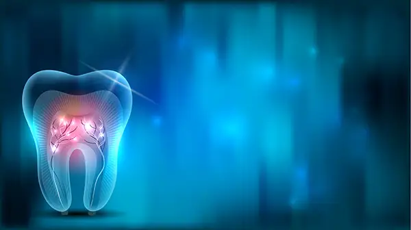 Abstract illustration of a tooth showing nerve inflammation, representing root canal treatment. Abstract illustration of a tooth showing nerve inflammation, representing root canal treatment.